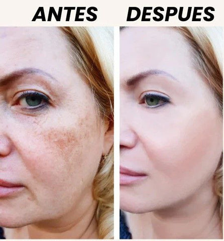 Image of Zamia™ - Crema Aclaradora Corporal